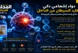 إشعاع ذكي يستهدف الخلايا السرطانية